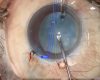 Dr LaHood Surgery