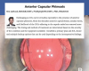 Anterior Capsular Phimosis