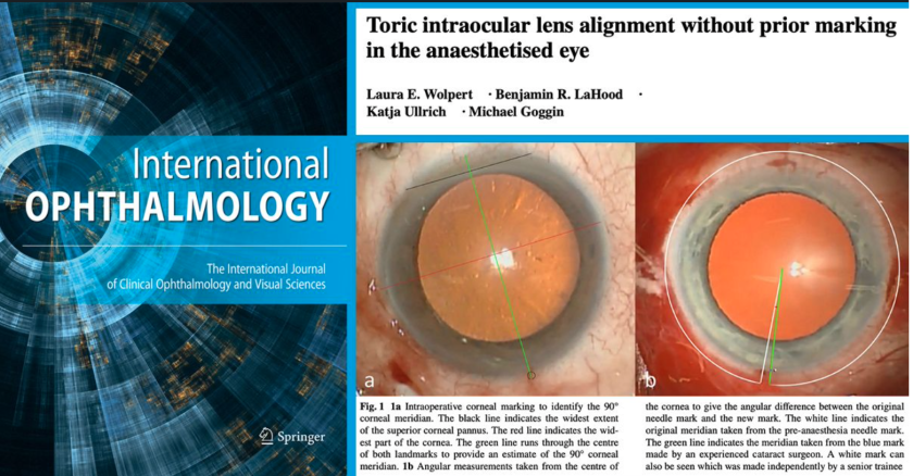 International Ophthalmology