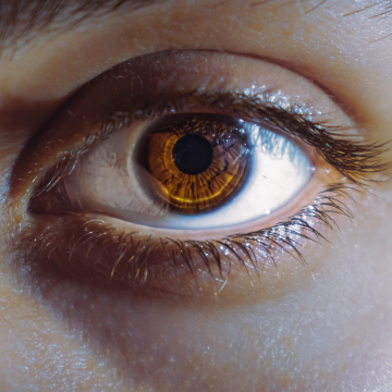 Hazel Eye